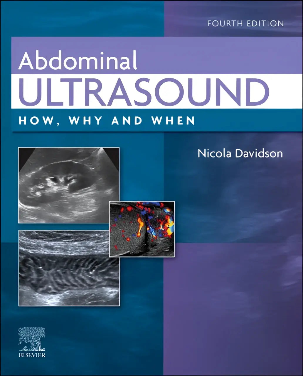 Vierde editie medische leerboek abdominal ultrasound how why and when door nicola davidson over abdominal ultrasound waarom en wanneer