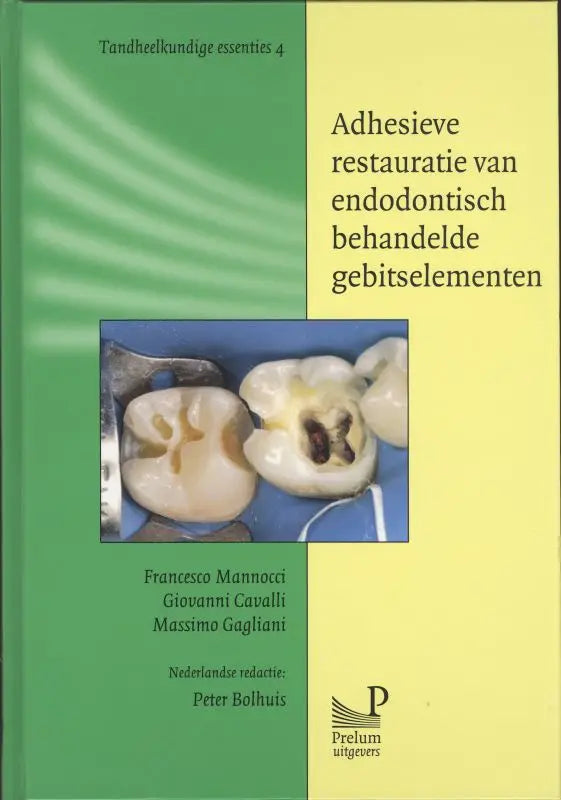 Groen en geel boek met foto van adhesieve restauratie van endodontisch behandelde gebitselementen