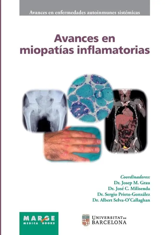Avances en miopatías inflamatorias