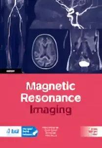 Display scherm van rood-witte magnetic resonance imaging machine met duidelijke resonantiebeeldweergave