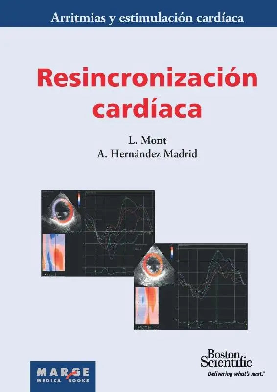 Resincronización cardíaca