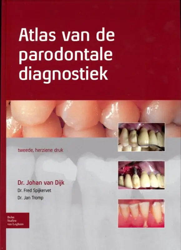 Rode hardcover atlas van de parodontale diagnostiek met tandheelkundige afbeeldingen door fred spijkervet bsl media