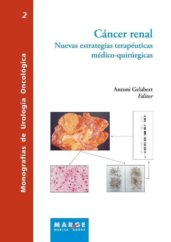 Cáncer renal - Nuevas estrategias terapéuticas médico-quirúrgicas