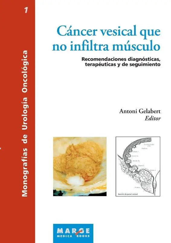 Cáncer vesical que no infiltra músculo - Recomendaciones diagnósticas, terapéuticas y de seguimiento