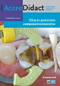 De kleurrijke glanzende directe posteriore composietrestauraties in plastic petrischaaltjes door bas loomans en niek opdam