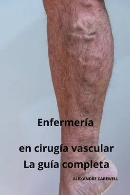 Enfermería en cirugía vascular - La guía completa