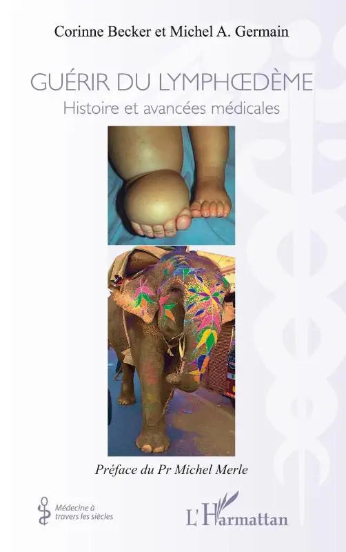 Guérir du lymphoedème - Histoires et avancées médicales