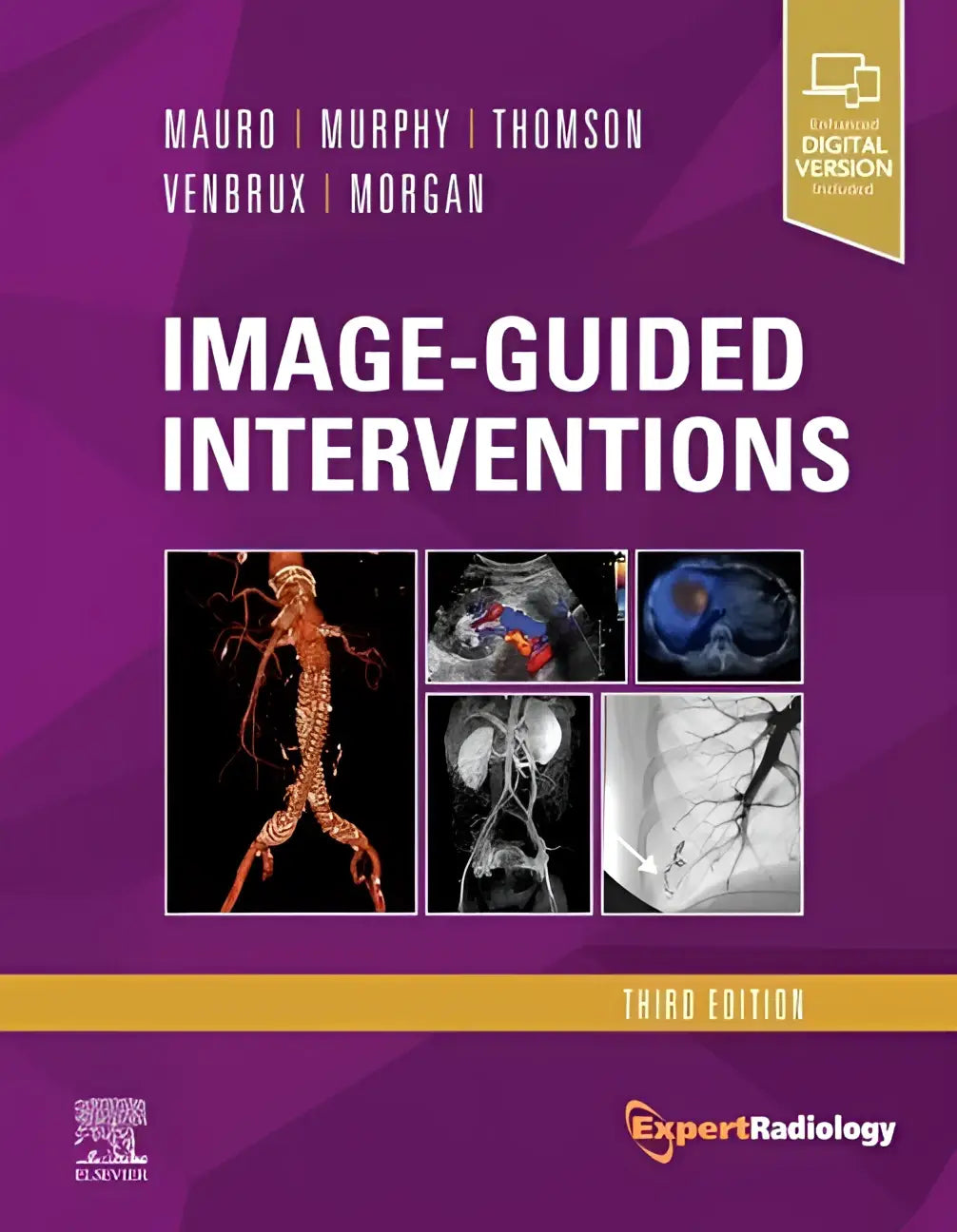 Purple hardcover medical textbook titled image-guided interventions third edition with four diagnostic scans cover from expert radiology series