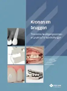 Brochure kronen en bruggen van prelum uitgevers met afbeeldingen van tanden, kronen en bruggen voor tandheelkunde