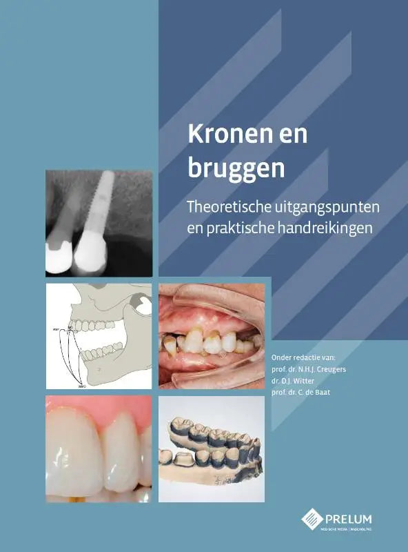 De voorkant van het nederlandse tandheelkundeboek kronen en bruggen door prelum uitgevers in heldere kleuren