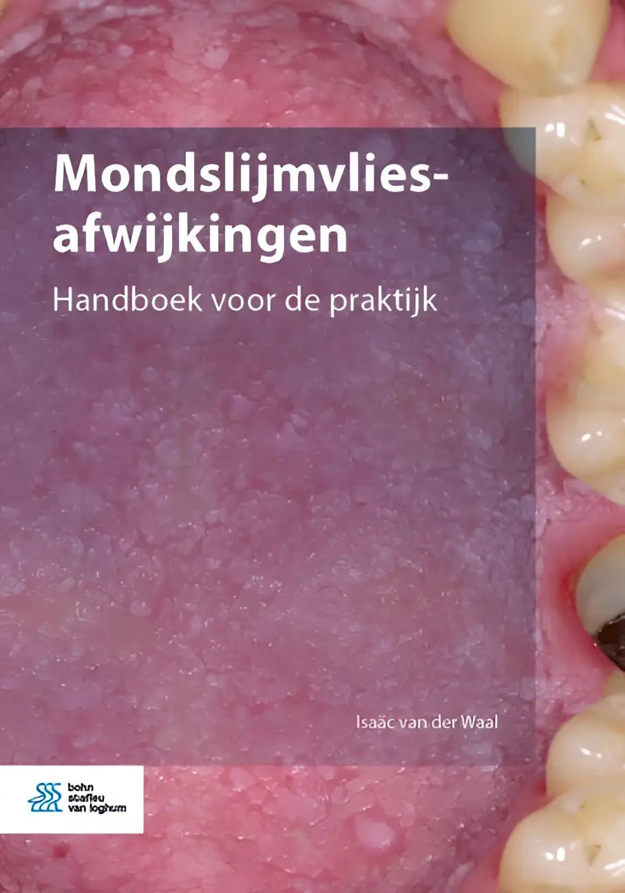 De boekcover van mondslijmvlies-afwijkingen handboek voor de praktijk door isaác van der waal gepubliceerd door bsl media