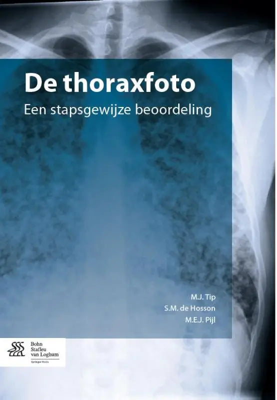 Blauw omslagen medisch leerboek de thoraxfoto met een röntgenfoto van de borstkas voor geneeskunde algemeen en bsl media